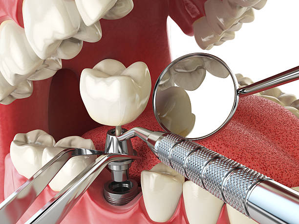 Best Cracked Tooth Emergency Dentist  in West Richland, WA